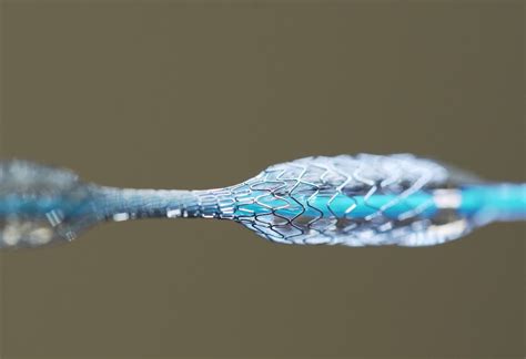  Nitinol: Un Alliage Superélastique révolutionnant l'Industrie Médicale !